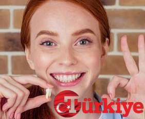 عمليات تجميل الاسنان تركيا تجميل الفك في اسطنبول افضل مستشفي اسنان سعر مميز